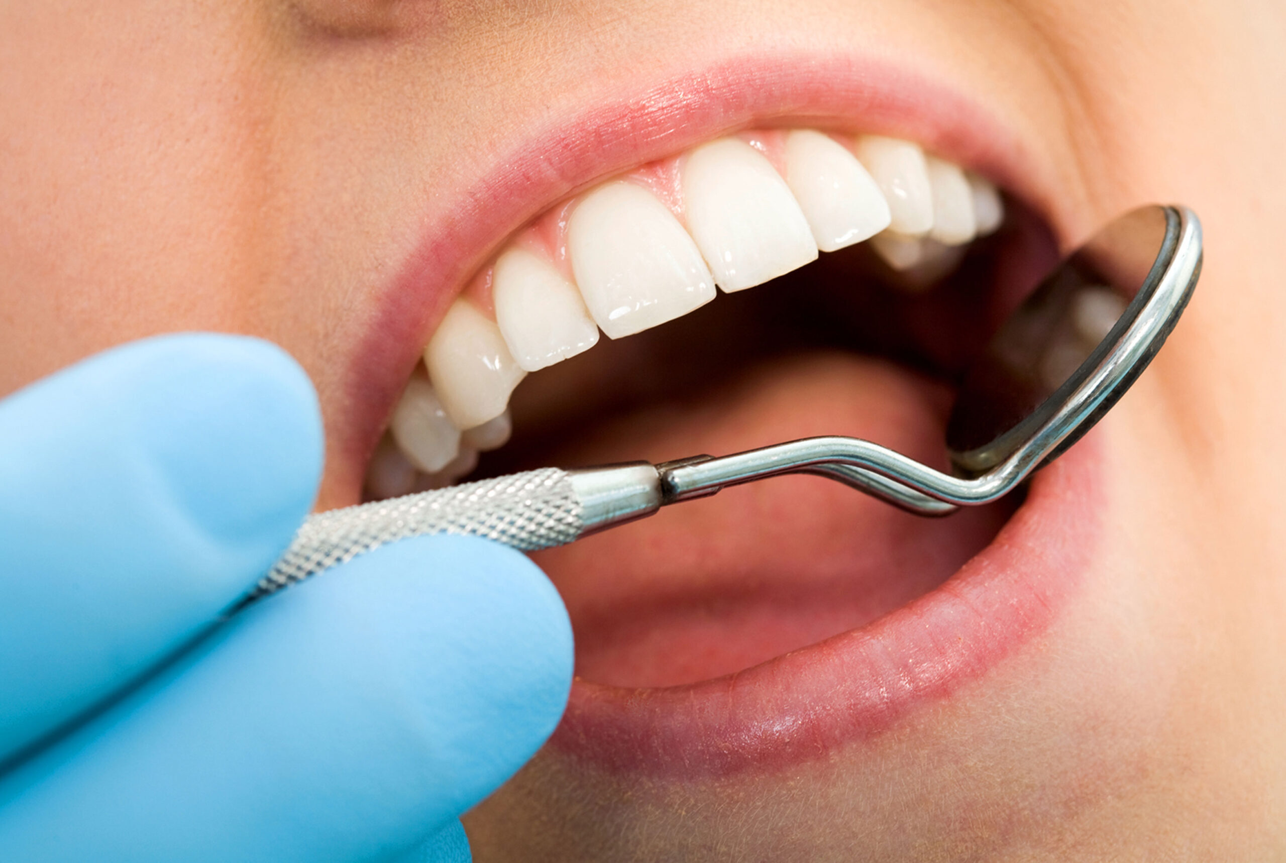 Dentist examining patient's teeth with dental mirror during general dentistry exam.