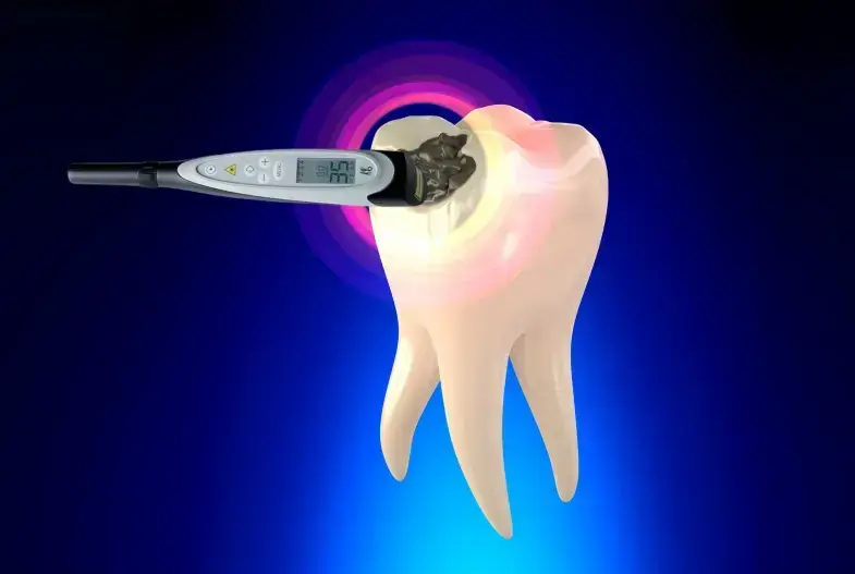 DIAGNOdent laser cavity detection device scanning a tooth model during diagnostic examination.