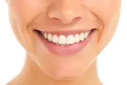 Close-up of woman's bright white smile showing healthy teeth and gums.