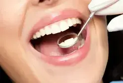 Close-up of a patient's bright white smile during a dental examination with mirror.
