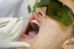Patient receiving dental laser treatment with protective eyewear in Las Vegas.