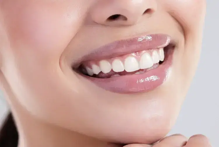 Close-up of a patient's bright white smile showing healthy teeth and gums after dental cleaning.