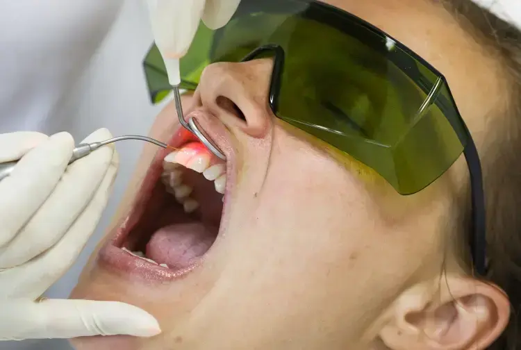 Patient receiving dental laser treatment on upper front teeth with protective eyewear.