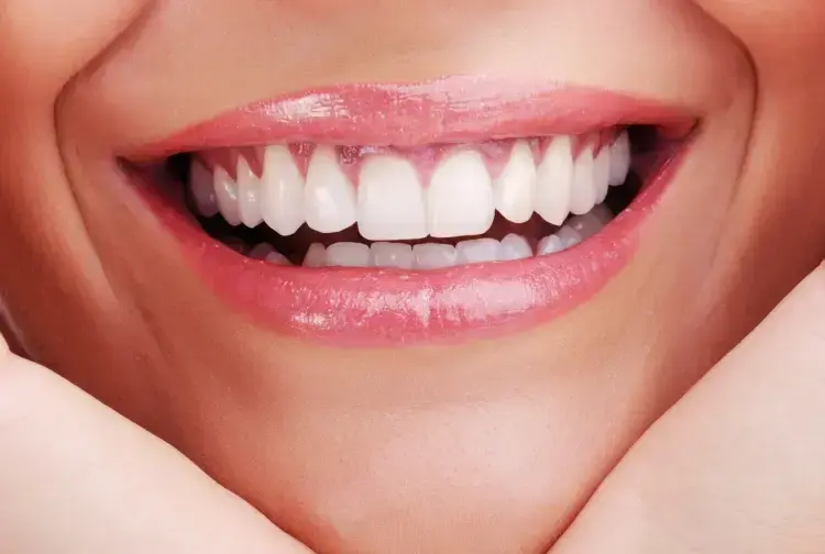 Closeup of a bright white smile showing healthy, perfectly aligned teeth with pink lips.