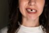 What Happens When You Leave a Missing Tooth Untreated?
